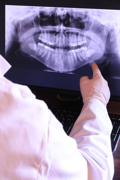Best Emergency Treatment for Dental Infections or Abscesses in Stanford, CA